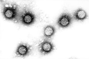 Te papillomavirus tangata